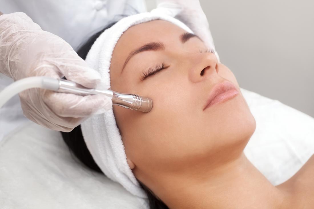 MDA (Microdermabrasion)
